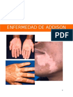 Enfermedad de Addison