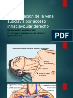 Cateterizaciòn de La Vena Subclavia Por Acceso Infraclavicular