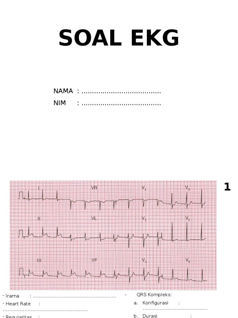 SOAL EKG