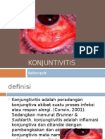 Konjuntivitis PPT 1