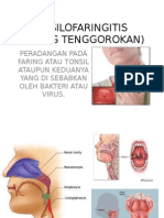 TONSILOFARINGITIS