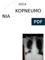 Soca Bronkopneumonia