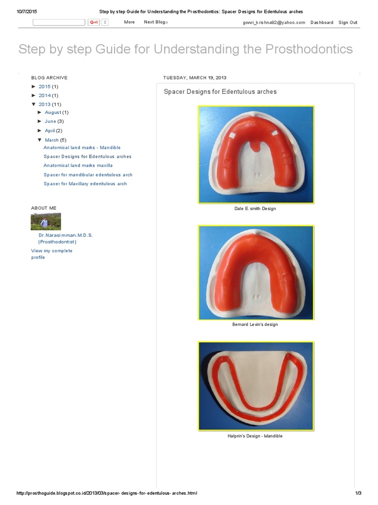Step by Step Guide For Understanding The Prosthodontics Spacer Designs For Edentulous Arches PDF