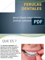 Ferulas Dentales