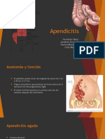 Cuadro de Apendicitis