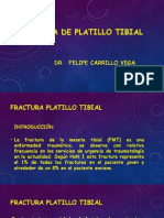 Fractura Platillo Tibial