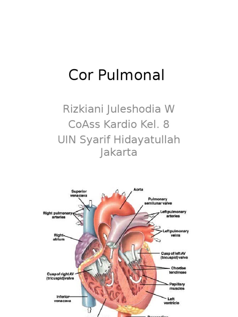 Cor Pulmonal.ppt