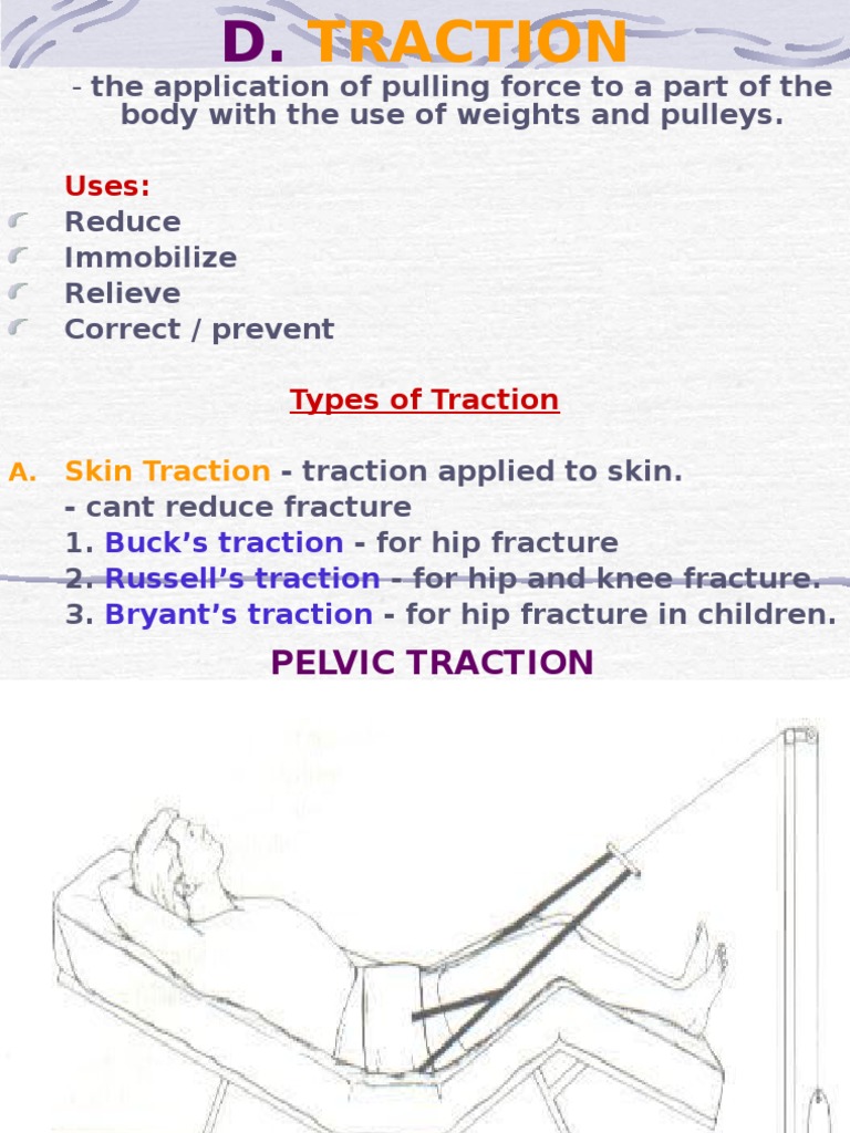 Types of skeletal traction