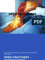 Open Fracture