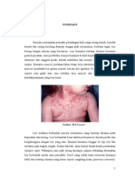 psoriasis.docx