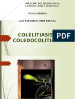 Colelitiasis