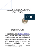 Agenesia Del Cuerpo Calloso