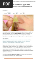 Artigo - Cravos Na Pele_ Aprenda a Fazer Cera Caseira Que Remove Os Pontinhos Pretos