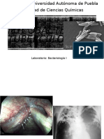 Mycobacterium Tuberculosis