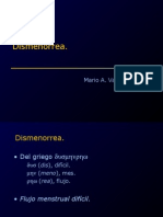 Dismenorrea