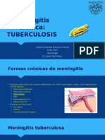 Neuroinfección Tuberculosis