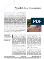 Mononucleosis