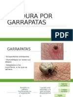 Picadura Por Garrapatas