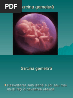 78330058-Sarcina-gemelara