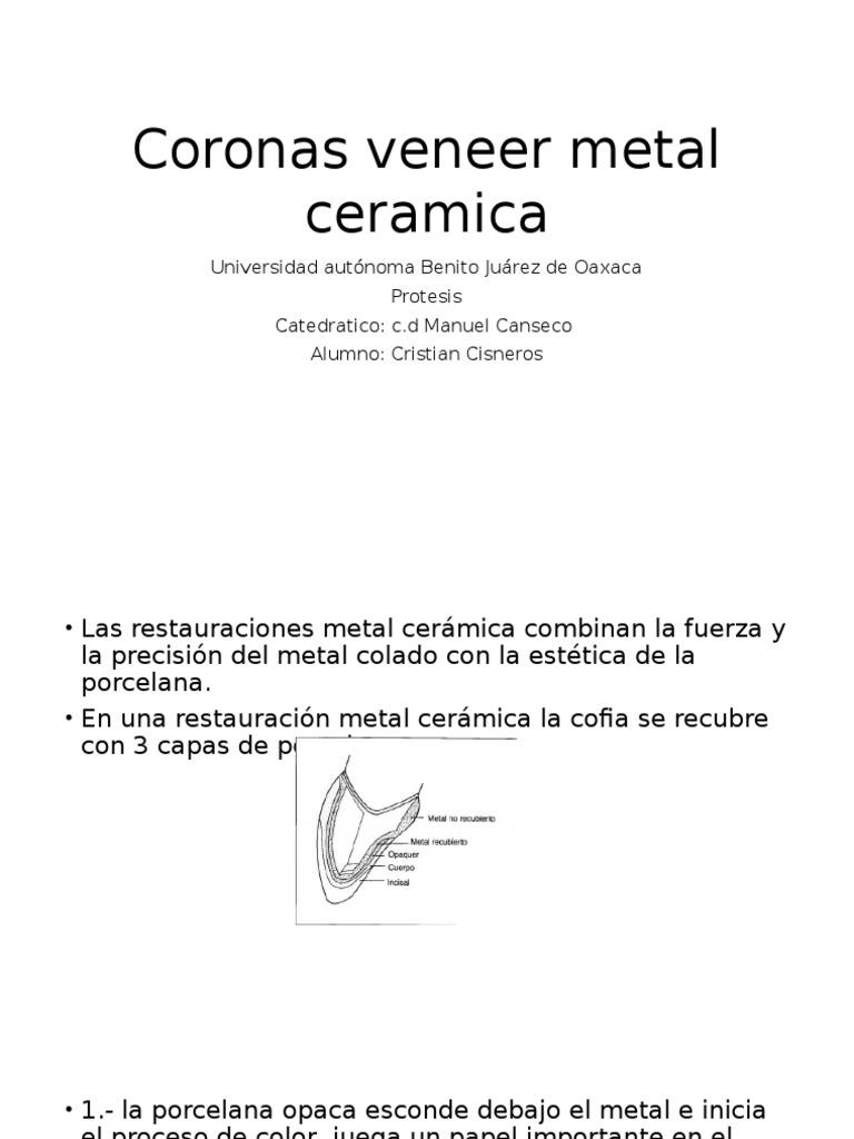 Coronas Veneer ¿Qué son, qué tipos existen y como se preparan