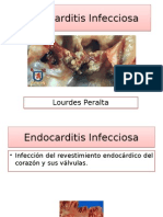 Endocarditis Infecciosa