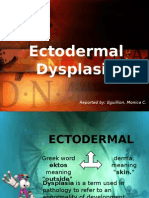Ectodermal Dysplasia-EGUILLION