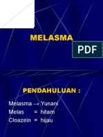 MELASMA