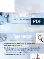 Amenorrea 