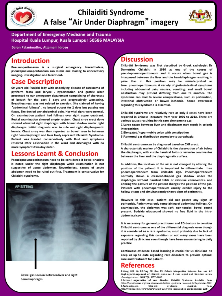 Chilaiditi Syndrome > A Benign Air under diaphragm Digestive