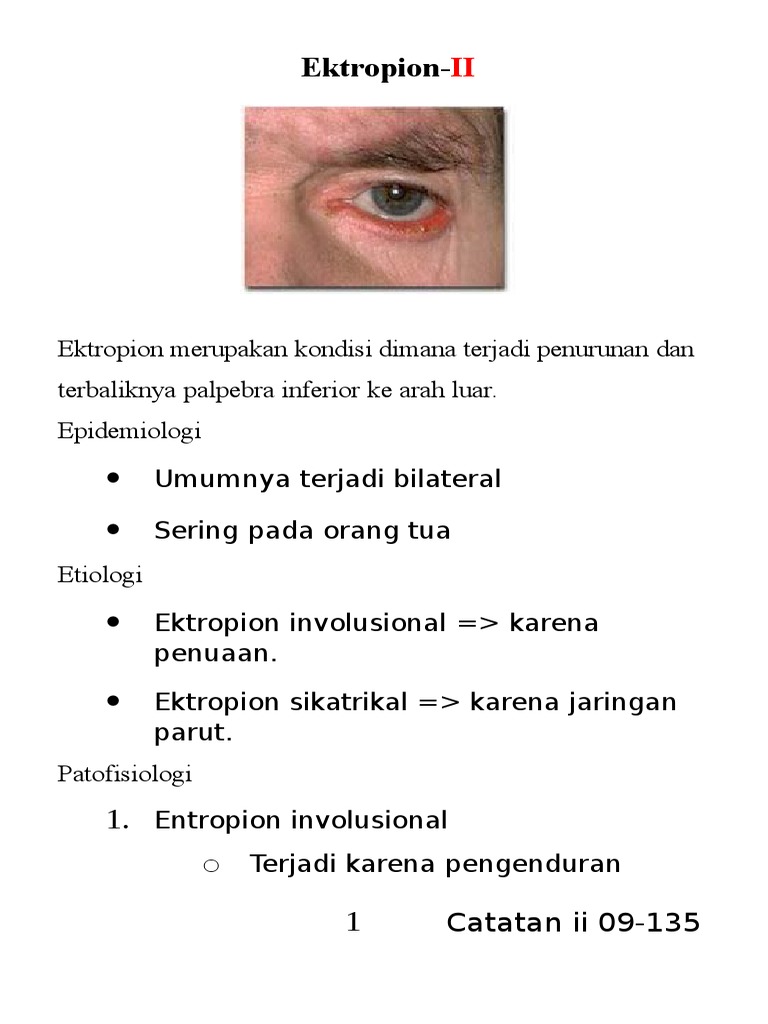 ektropion