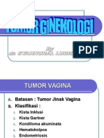 Tumor Ginekologi