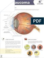 Glaucoma