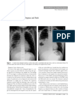 A 7-Year-Old Girl With Dyspnea and Rash: Answertophotoquiz