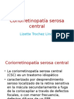 Coriorretinopatía Serosa Central