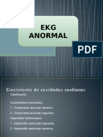 Ekg Anormal