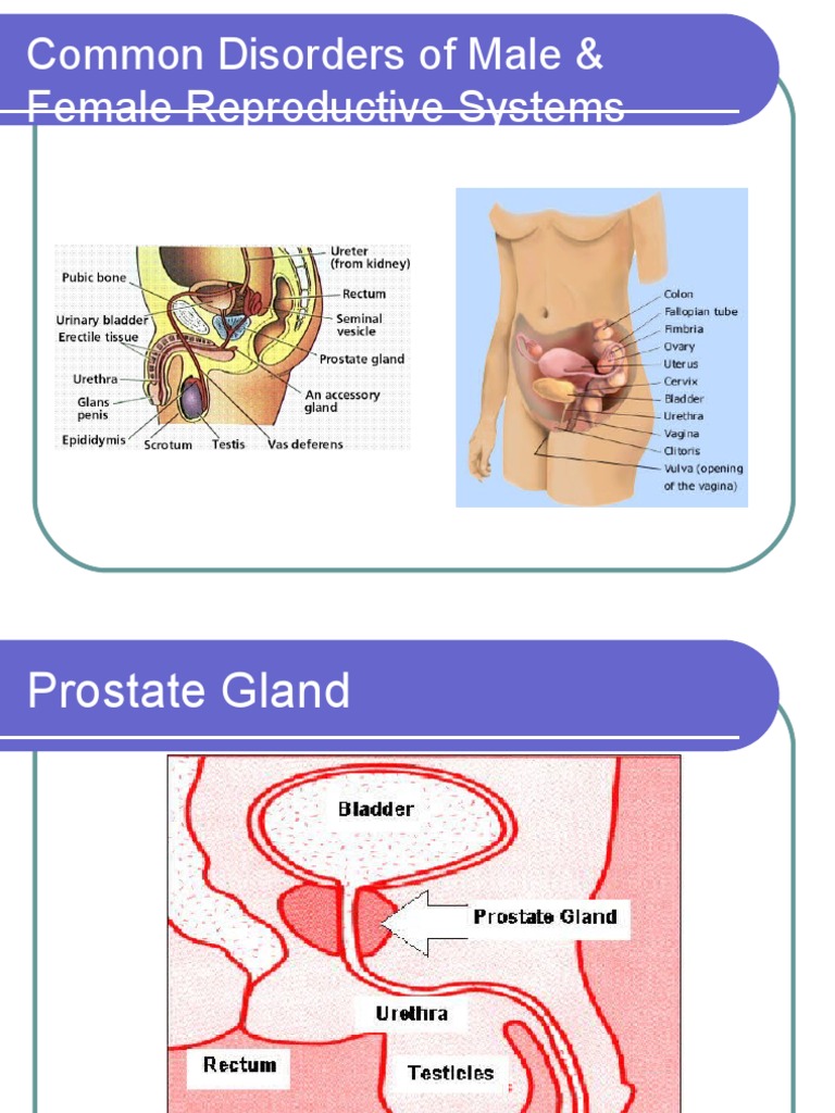 Common Disorders of Male & Female Reproductive Systems | PDF | Prostate ...