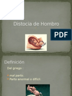 Distocia de Hombro