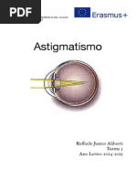 Astigmatismo