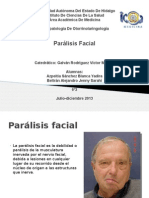 Paralisis Facial 