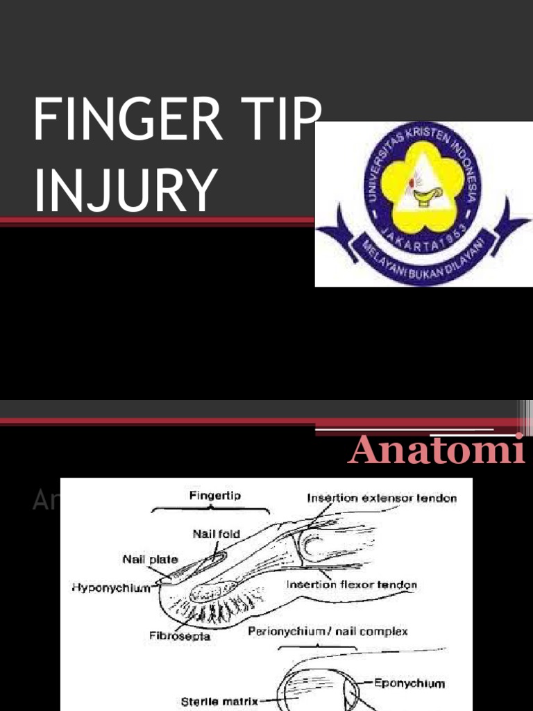 Finger Tip Injury Bedah | PDF