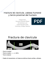 Fractura de Clavícula ,Cabeza Humeral y Tercio