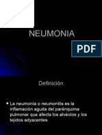 Neumonia 091030134340 Phpapp02