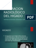 Higado