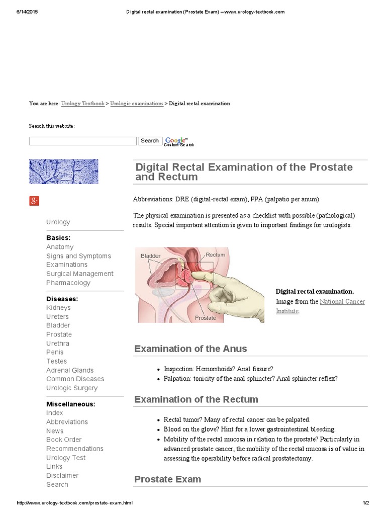 Digital Rectal Examination (Prostate Exam) Www.urologytextbook