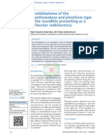 acanthomatous plexiform