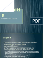 Vaginitis 