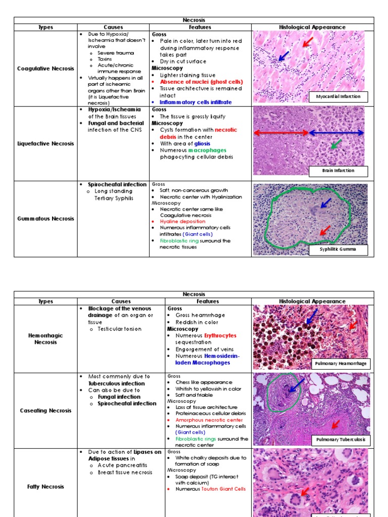 Types of Necrosis and Infarct Necrosis Ischemia
