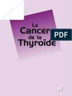 Cancer de la  Thyroide