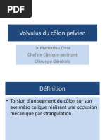 Volvulus Du Colon Pelvien