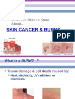 Skin Cancer and Burns